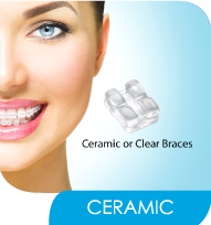 Ceramic or Clear Braces