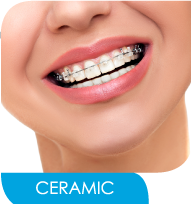 Ceramic or Clear Braces