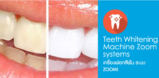 เครื่องฟอกสีฟัน ระบบ ZOOM - คลินิกจัดฟัน เชียงใหม่