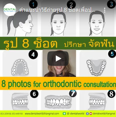How to take photo for Orthodontic consultation​